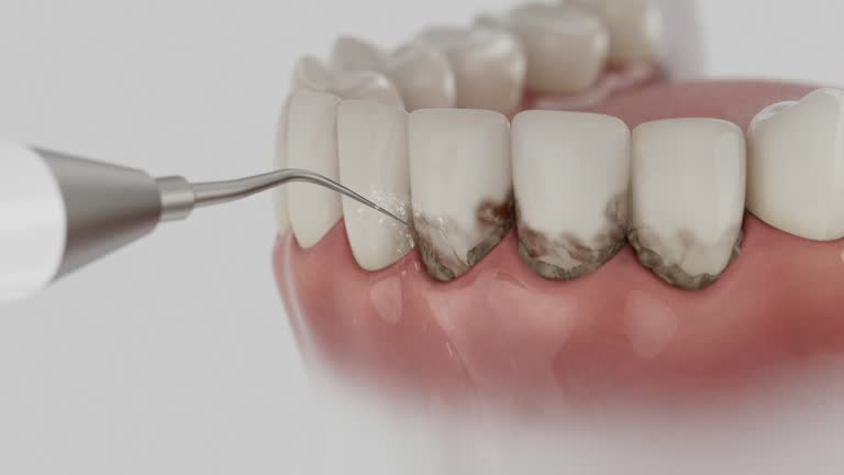 Reliable Tooth Extraction contractor in Dade County County, GA by Dentist Open Now